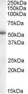 Western Blot: Aromatase Antibody [NB100-93375]