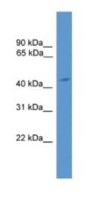 Western Blot: Arrestin 3 Antibody [NBP1-69083]