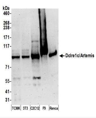 Western Blot: Artemis Antibody [NBP2-44276]