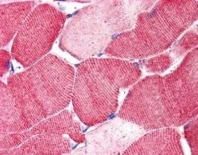 Immunohistochemistry-Paraffin: Arylsulfatase B/ARSB Antibody [NBP1-06021]