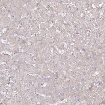 Immunohistochemistry-Paraffin: Arylsulfatase B/ARSB Antibody [NBP1-85879]