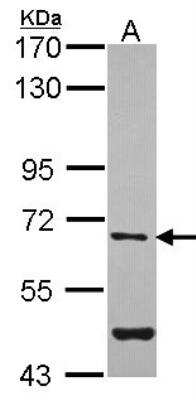 Western Blot: Arylsulfatase G/ARSG Antibody [NBP1-33772]