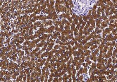 Immunohistochemistry-Paraffin: Asialoglycoprotein Receptor 2 Antibody (002) [NBP3-06211]