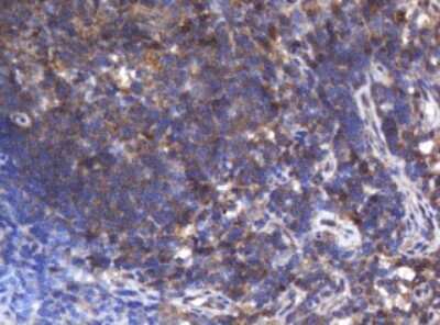 Immunohistochemistry: Asialoglycoprotein Receptor 2 Antibody (OTI2A12) [NBP2-45505]