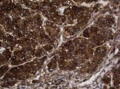 Immunohistochemistry: Asialoglycoprotein Receptor 2 Antibody (OTI2A12) [NBP2-45505]