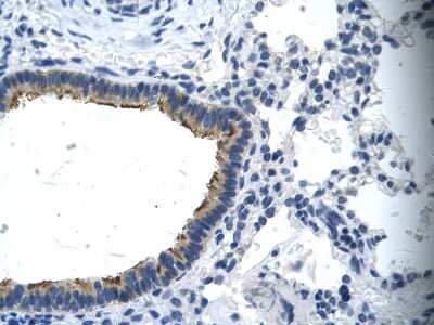 Immunohistochemistry: Asialoglycoprotein Receptor 2 Antibody [NBP1-52958]