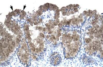 Immunohistochemistry-Paraffin: Asialoglycoprotein Receptor 2 Antibody [NBP1-52958]