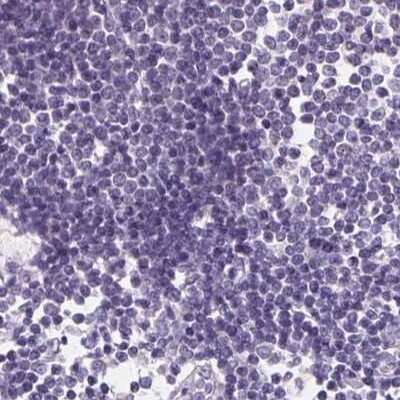Immunohistochemistry-Paraffin: Asialoglycoprotein Receptor 2 Antibody [NBP1-85578]