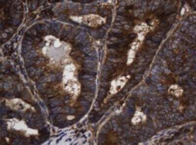 Immunohistochemistry: Asialoglycoprotein Receptor 2 Antibody (OTI2A12) - Azide and BSA Free [NBP2-70212]