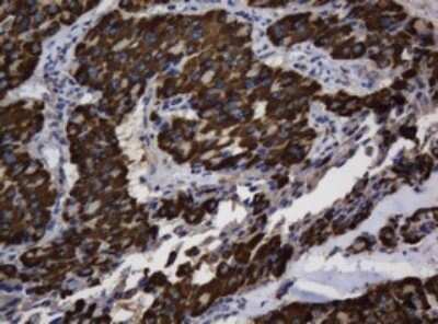 Immunohistochemistry: Asialoglycoprotein Receptor 2 Antibody (OTI2A12) - Azide and BSA Free [NBP2-70212]