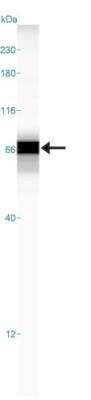 Simple Western: Asialoglycoprotein Receptor 2 Antibody [NBP1-85578]