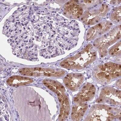 Immunohistochemistry-Paraffin: Asparaginase Antibody [NBP2-49617]
