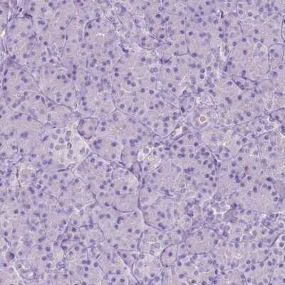 Immunohistochemistry-Paraffin: Asparaginase Antibody [NBP2-49617]