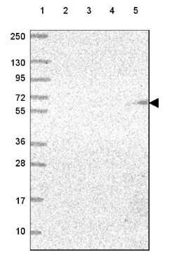 Western Blot: Asparaginase Antibody [NBP2-49617]