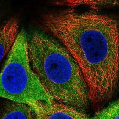 Immunocytochemistry/ Immunofluorescence: Asparagine synthetase Antibody [NBP2-56407]