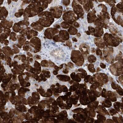 Immunohistochemistry-Paraffin: Asparagine synthetase Antibody [NBP1-87444]