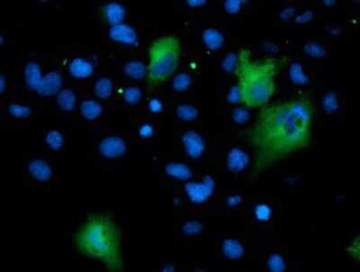 Immunocytochemistry/ Immunofluorescence: Asparagine synthetase Antibody (OTI1A10) - Azide and BSA Free [NBP2-70215]