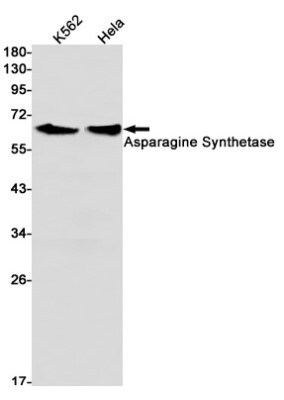 Western Blot: Asparagine synthetase Antibody (S05-9E5) [NBP3-19507]