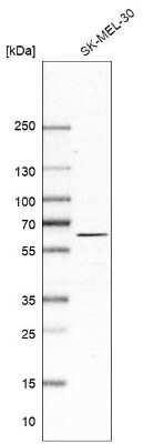 Western Blot: Asparagine synthetase Antibody [NBP1-87444]