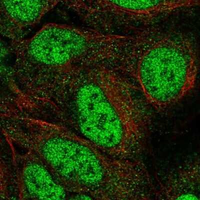 Immunocytochemistry/ Immunofluorescence: Aspartate Aminotransferase Antibody [NBP2-57518]