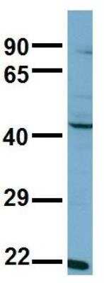 Western Blot: Aspartate Aminotransferase Antibody [NBP1-54778]