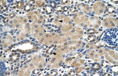 Immunohistochemistry: Aspartate beta hydroxylase Antibody [NBP1-69230]