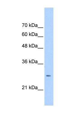 Western Blot: Aspartate beta hydroxylase Antibody [NBP1-69229]