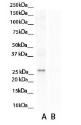 Western Blot: Aspartate beta hydroxylase Antibody [NBP1-69229]