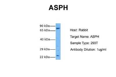 Western Blot: Aspartate beta hydroxylase Antibody [NBP1-69229]