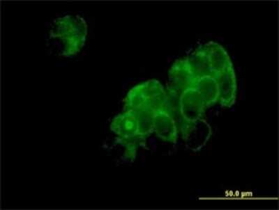 Immunocytochemistry/ Immunofluorescence: Aspartyl Aminopeptidase Antibody (2F9-3A7) [H00023549-M01]