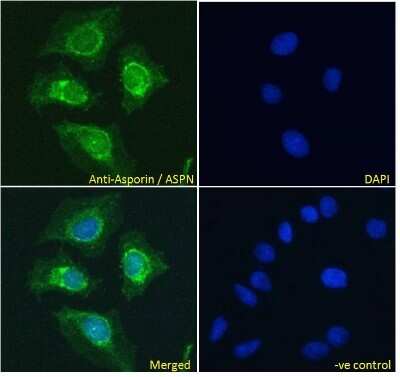 Immunocytochemistry/ Immunofluorescence: Asporin Antibody [NB100-1514]
