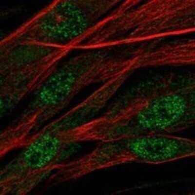 Immunocytochemistry/ Immunofluorescence: Asporin Antibody [NBP3-17805]