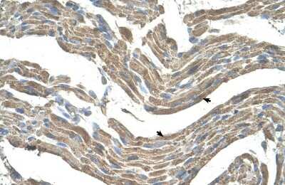Immunohistochemistry-Paraffin: Asporin Antibody [NBP1-58061]