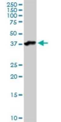 Western Blot: Asporin Antibody [H00054829-D01P]
