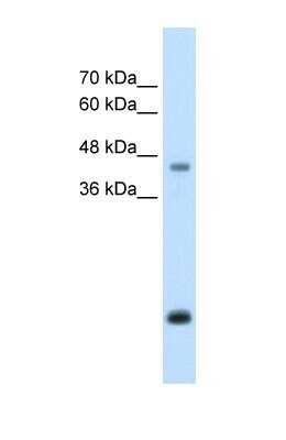 Western Blot: Asporin Antibody [NBP1-58061]