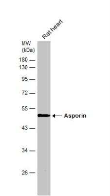 Western Blot: Asporin Antibody [NBP2-15492]