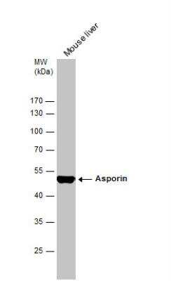 Western Blot: Asporin Antibody [NBP2-15492]