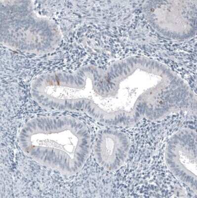Immunohistochemistry-Paraffin: Astrin Antibody (CL10078) [NBP2-88942]