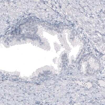 Immunohistochemistry-Paraffin: Astrin Antibody (CL10078) [NBP2-88942]