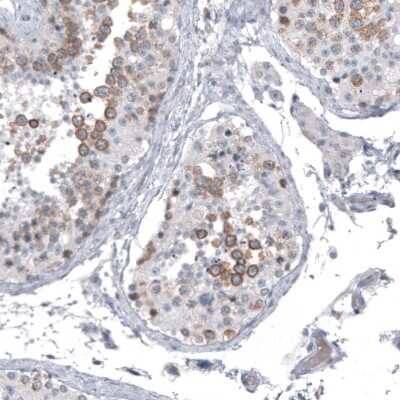 Immunohistochemistry-Paraffin: Astrin Antibody (CL10078) [NBP2-88942]