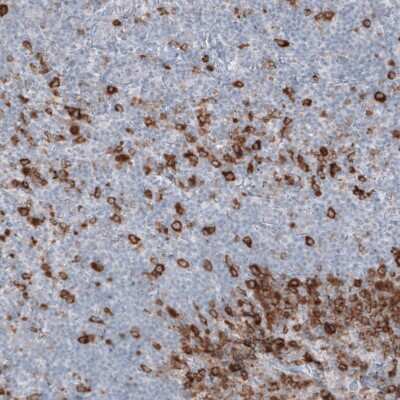 Immunohistochemistry-Paraffin: Astrin Antibody (CL10078) [NBP2-88942]