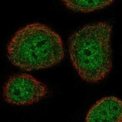 Immunocytochemistry/ Immunofluorescence: Atad5 Antibody [NBP3-17568]
