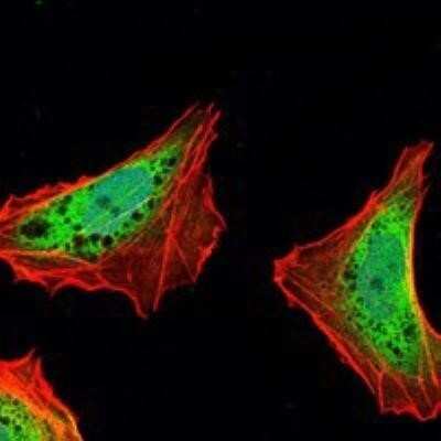 Immunocytochemistry/ Immunofluorescence: Ataxin 1 Antibody (2F5) - BSA Free [NBP1-51689]