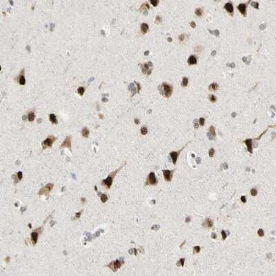 Immunohistochemistry-Paraffin: Ataxin 1 Antibody [NBP1-90065]