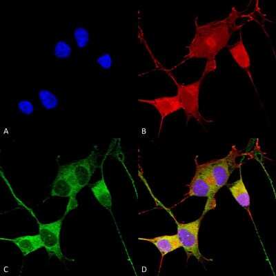 Immunocytochemistry/ Immunofluorescence: Ataxin 1 Antibody (S76-8) [NBP2-42186]