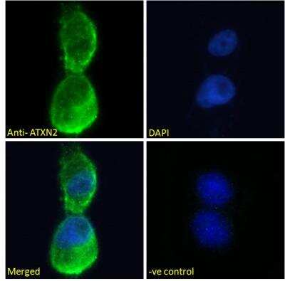 Immunocytochemistry/ Immunofluorescence: Ataxin-2 Antibody [NBP2-76807]