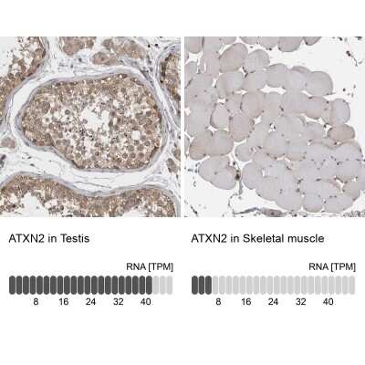 Immunohistochemistry-Paraffin: Ataxin-2 Antibody [NBP1-90062]
