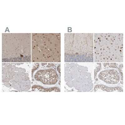Immunohistochemistry-Paraffin: Ataxin-2 Antibody [NBP1-90062]