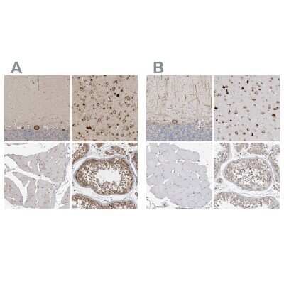 Immunohistochemistry-Paraffin: Ataxin-2 Antibody [NBP1-90064]