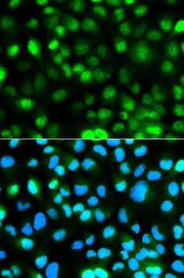 Immunocytochemistry/ Immunofluorescence: Ataxin-3 Antibody - BSA Free [NBP2-92611]
